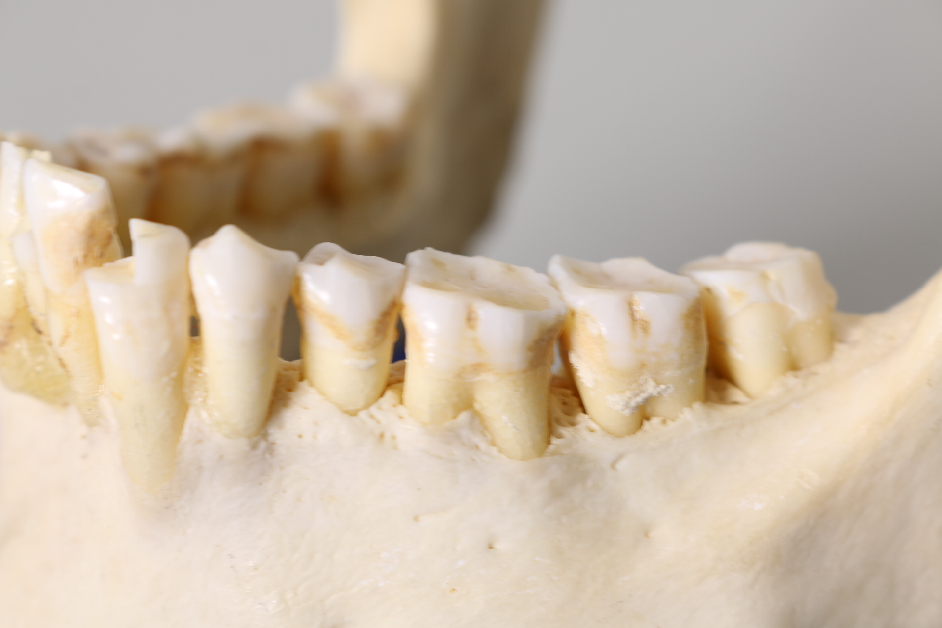 Nahaufnahme eines menschlichen Unterkiefers mit Zähnen, eingebettet in einem weißen Schaumstoffblock zur Konservierung.