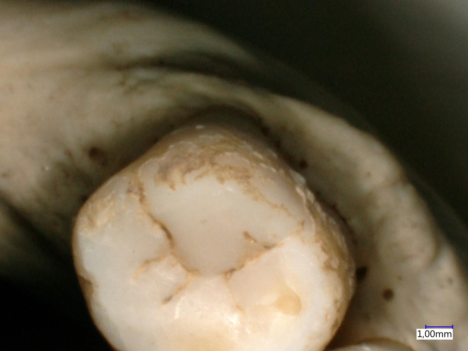 Nahaufnahme eines menschlichen Zahns mit sichtbaren Dentinschichten und Maßstab (1,00 mm) für Größenvergleich.